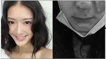 明星破相图片,揭秘事故瞬间，勇敢面对挑战